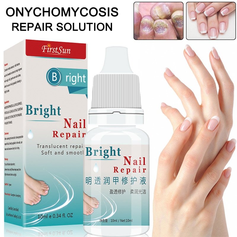 10ml Nail Fungal Treatment , ,Anti Fungus Onychomycosis Removal Toenail