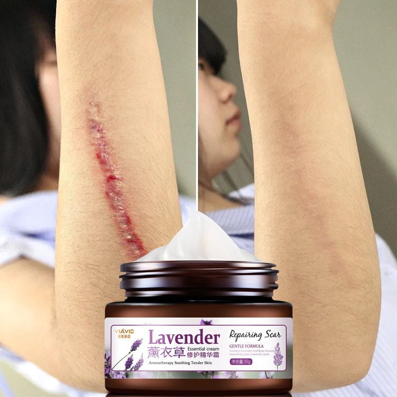 soap to lighten scars