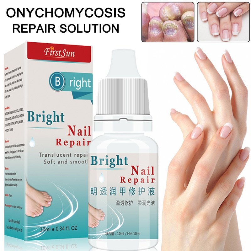10ml Nail Fungal Treatment , ,Anti Fungus Onychomycosis Removal Toenail ...
