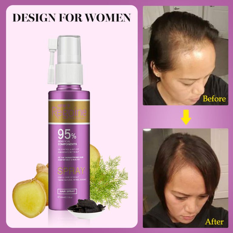Hair Growth Treatment, Oil for Anti Hair Loss , Essence Fast Thick Hair